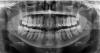 Radiografias dentales en flores